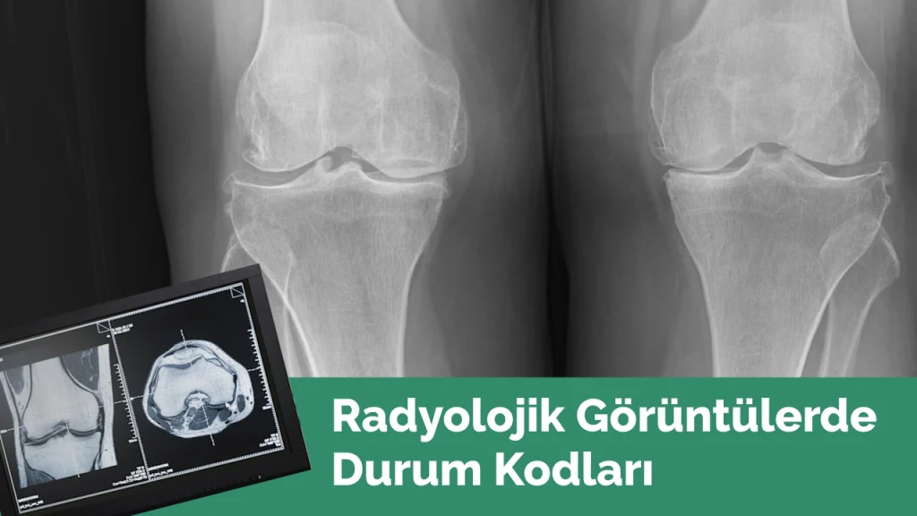Radyoloji Durum Kodu