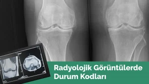 Radyoloji Durum Kodu