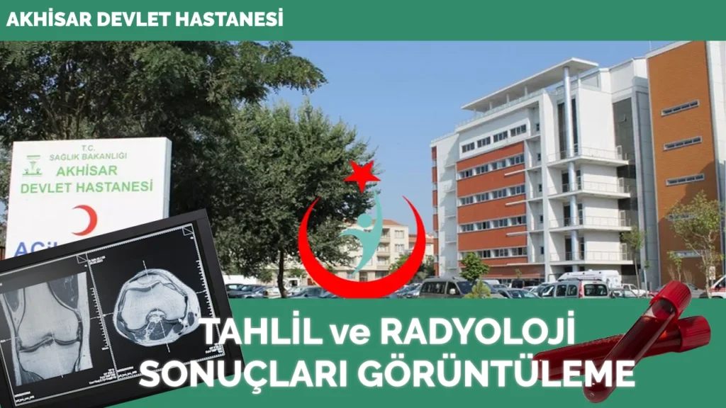 Akhisar Mustafa Kirazoğlu Devlet Hastanesi