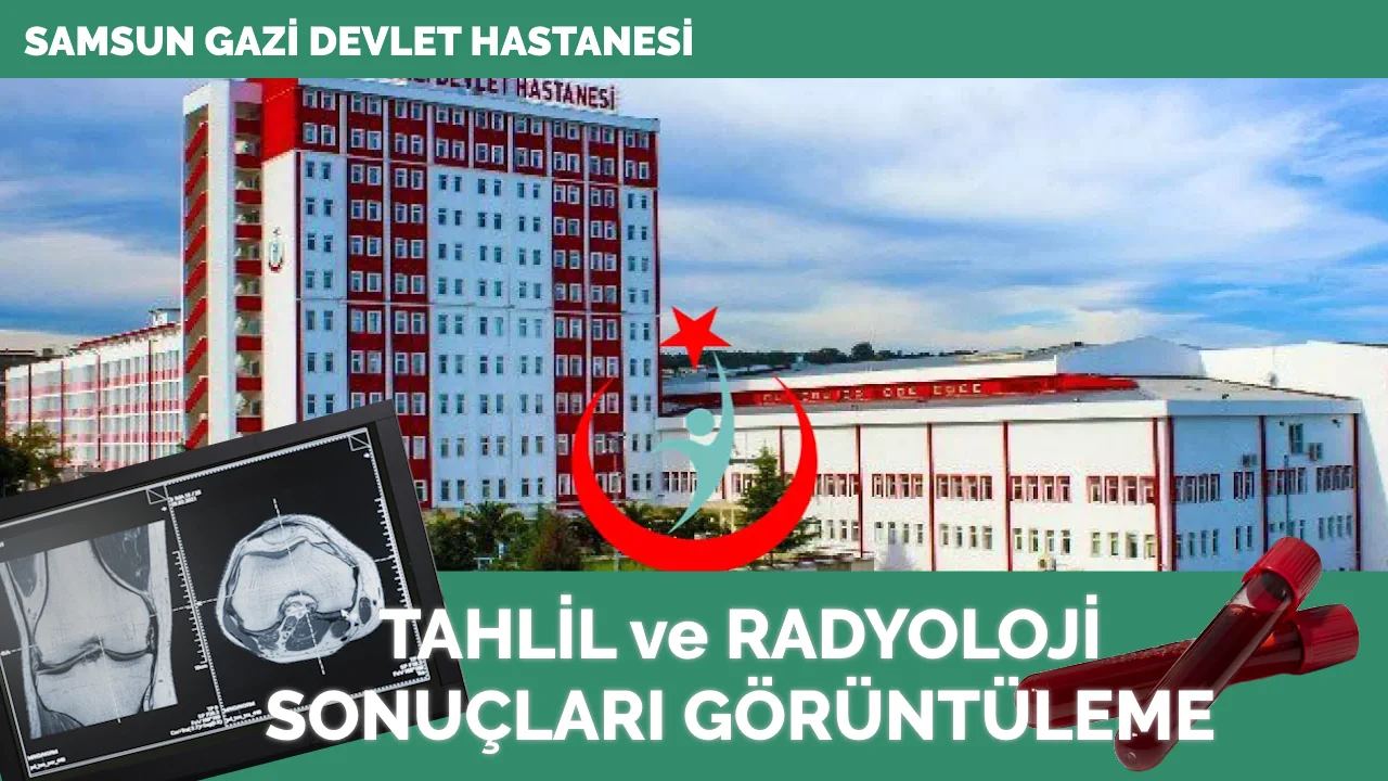 Samsun Gazi Devlet Hastanesi