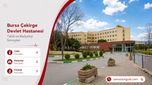 Çekirge Devlet Hastanesi