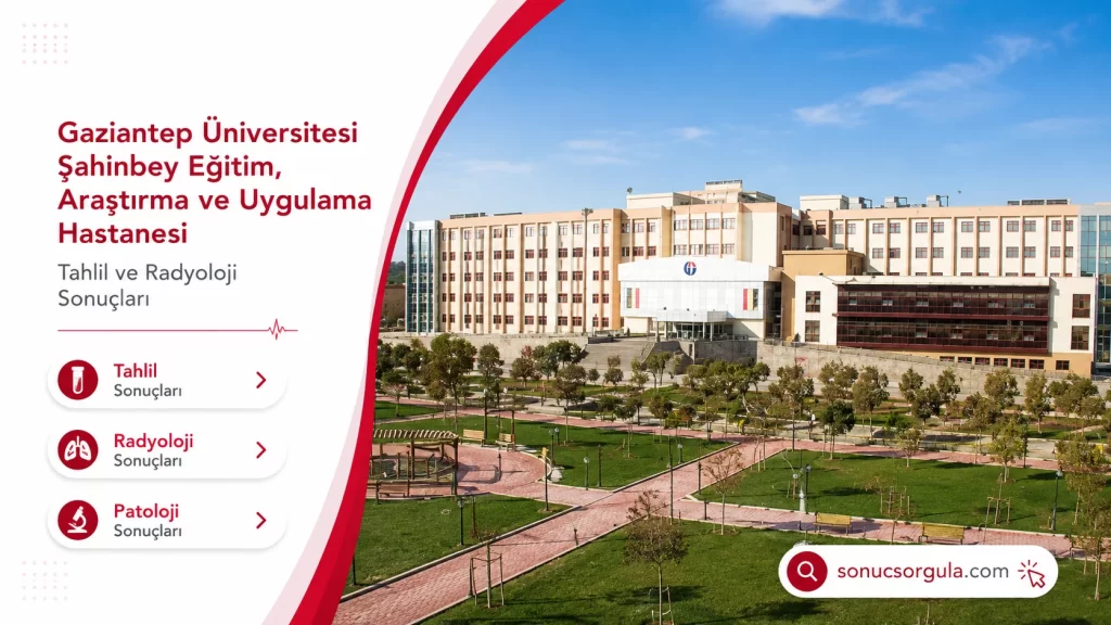 Gaziantep Üniversitesi Hastanesi