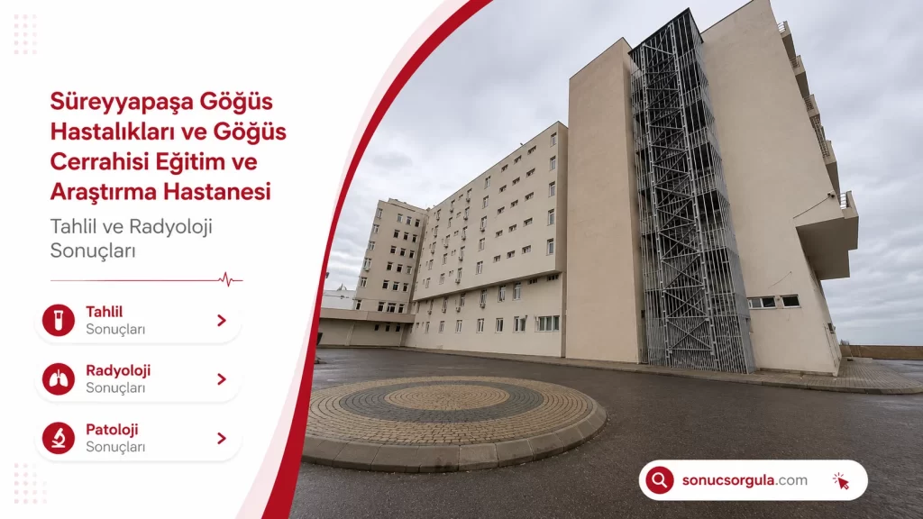 Süreyyapaşa Göğüs Hastalıkları E.A.H